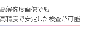 高解像度画像でも高精度で安定した検査が可能