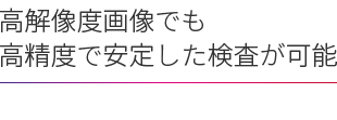 高解像度画像でも高精度で安定した検査が可能